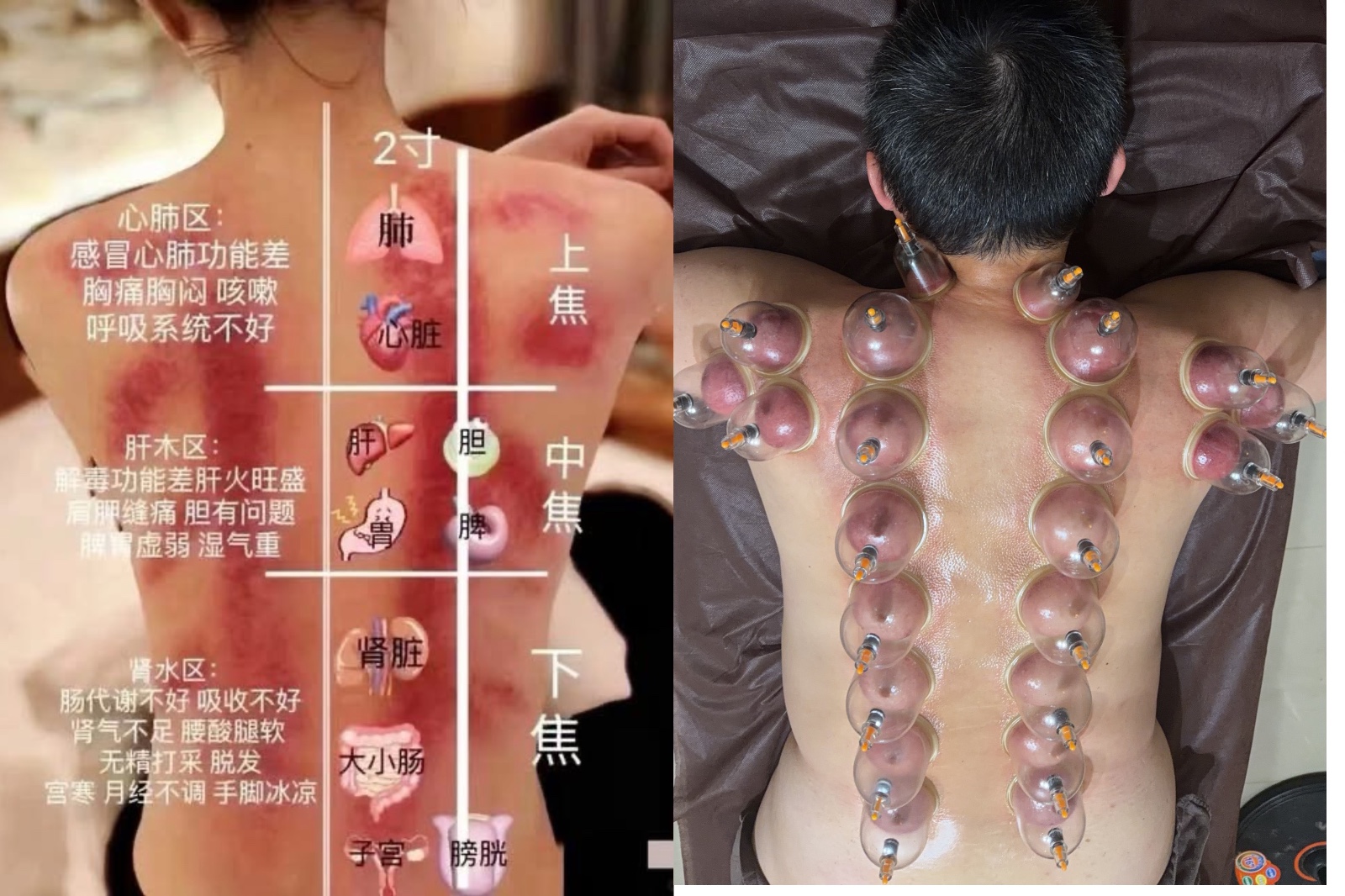 快樂花花